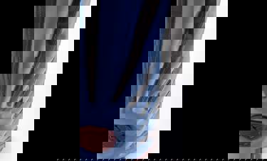 Feather Weight | גיל הרץ