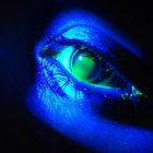 מהי מחלת ניוון הקרנית? (קרטוקונוס)