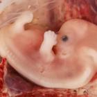 סמינר: "חשיפות סביבתיות במהלך ההריון"