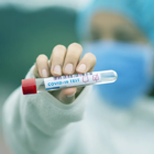 דני זאבי על שימוש בבדיקות קורונה מהירות