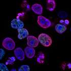 סמינר: פיתוח טיפולים תאיים-מיטוכונדריאליים למחלות מיטוכונדריאליות חשוכות מרפא