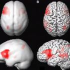 ראיון שהתקיים בערוץ 12 בתכנית של פאולה וליאון עם חבר ומנהלת מכון אדלר לאפזיה